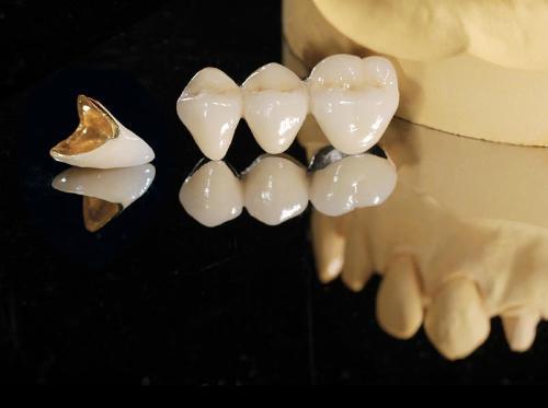 烤瓷牙贴片是如何清洗的